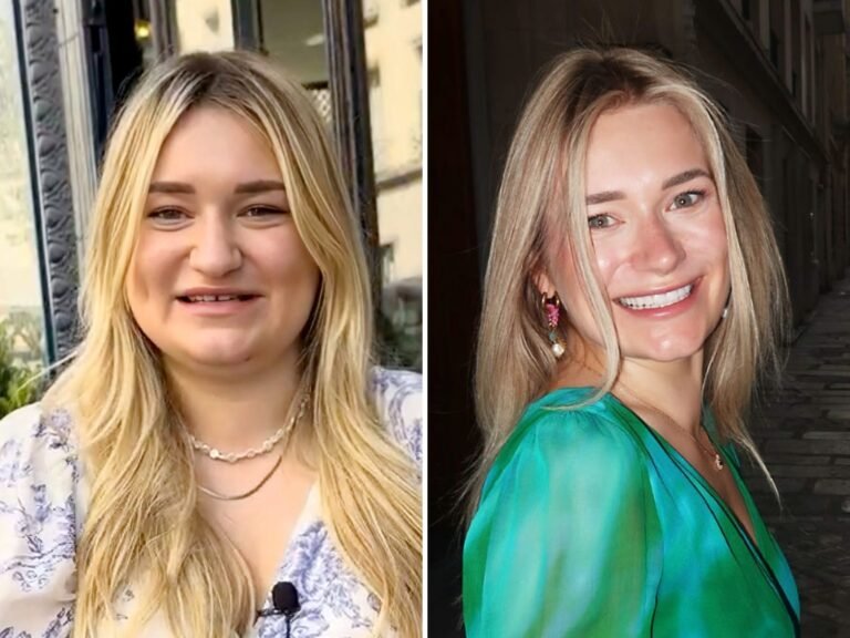 After a break-up, I paid $20K for a glow-up at 28. People on social media accuse me of using AI because I look so different.