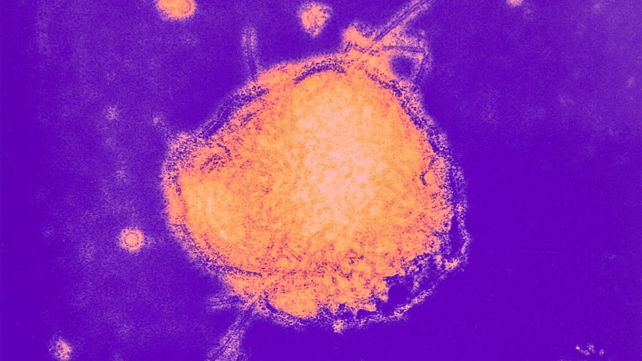 Measles outbreaks surge to top 3,500 cases this year: These tracker maps show the areas hardest hit 