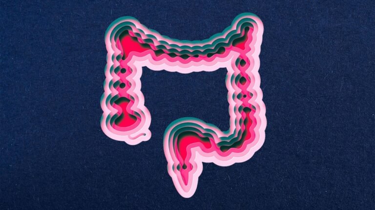Colon cancer rates are rising for the first time in 20 years. Here’s who’s most at risk